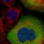 Immunofluorescent staining of human cell line A-431 shows localization to cytosol.