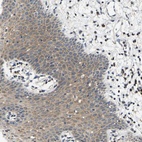 Anti-AHNAK Antibody