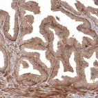 Immunohistochemical staining of human prostate shows moderate membranous positivity in glandular cells.