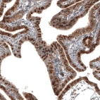 Immunohistochemical staining of human Fallopian tube shows strong cytoplasmic / membranous positivity in glandular cells.