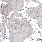 Immunohistochemical staining of human skeletal muscle shows low positivity in myocytes as expected.