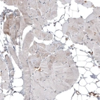 Immunohistochemical staining of human skeletal muscle shows low positivity in myocytes as expected.