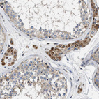 Immunohistochemical staining of human testis shows strong granular cytoplasmic positivity in Leydig cells.