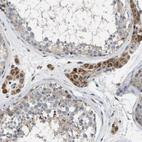 Immunohistochemical staining of human testis shows strong granular cytoplasmic positivity in Leydig cells.