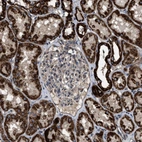 Immunohistochemical staining of human kidney shows strong granular cytoplasmic positivity in cells in tubules.
