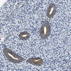 Immunohistochemical staining of human endometrium shows moderate granular cytoplasmic positivity in glandular cells.
