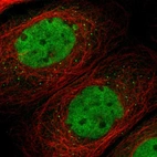 Immunofluorescent staining of human cell line A-431 shows localization to nucleoplasm & vesicles.