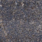 Immunohistochemical staining of human lymph node using Anti-SERTAD2 antibody HPA019021.