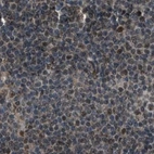 Immunohistochemical staining of human lymph node using Anti-SERTAD2 antibody HPA019021.
