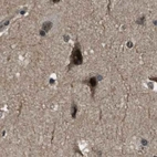 Immunohistochemical staining of human cerebral cortex using Anti-SERTAD2 antibody HPA019021.