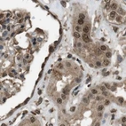 Immunohistochemical staining of human kidney using Anti-SERTAD2 antibody HPA019021.