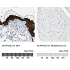 Anti-SERPINB5 Antibody