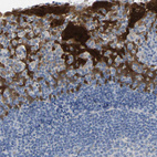 Immunohistochemical staining of human tonsil shows strong cytoplasmic positivity in squamous epithelial cells.