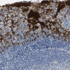 Immunohistochemical staining of human tonsil shows strong cytoplasmic positivity in squamous epithelial cells.
