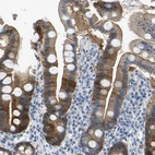 Immunohistochemical staining of human upper gastrointestinal shows weak to moderate cytoplasmic/membranous positivity in glandular cells.
