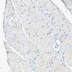 Immunohistochemical staining of human skeletal muscle shows no positivity in myocytes as expected.