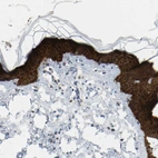 Immunohistochemical staining of human skin shows strong positivity in squamous epithelial cells.