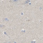 Immunohistochemical staining of human cerebral cortex using Anti-SERPINB5 antibody HPA019025.