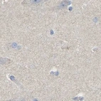 Immunohistochemical staining of human cerebral cortex using Anti-SERPINB5 antibody HPA019025.