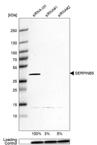 Western blot analysis in HeLa cells transfected with control siRNA, target specific siRNA probe #1 and #2, using Anti-SERPINB5 antibody. Remaining relative intensity is presented. Loading control: Anti-PPIB.