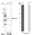 Western blot analysis in human cell lines PC-3 and Caco-2 using Anti-SERPINB5 antibody. Corresponding SERPINB5 RNA-seq data are presented for the same cell lines. Loading control: Anti-HSP90B1.
