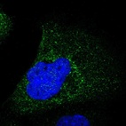 Immunofluorescent staining of human cell line A-431 shows positivity in cytoplasm.