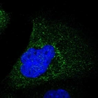 Immunofluorescent staining of human cell line A-431 shows positivity in cytoplasm.