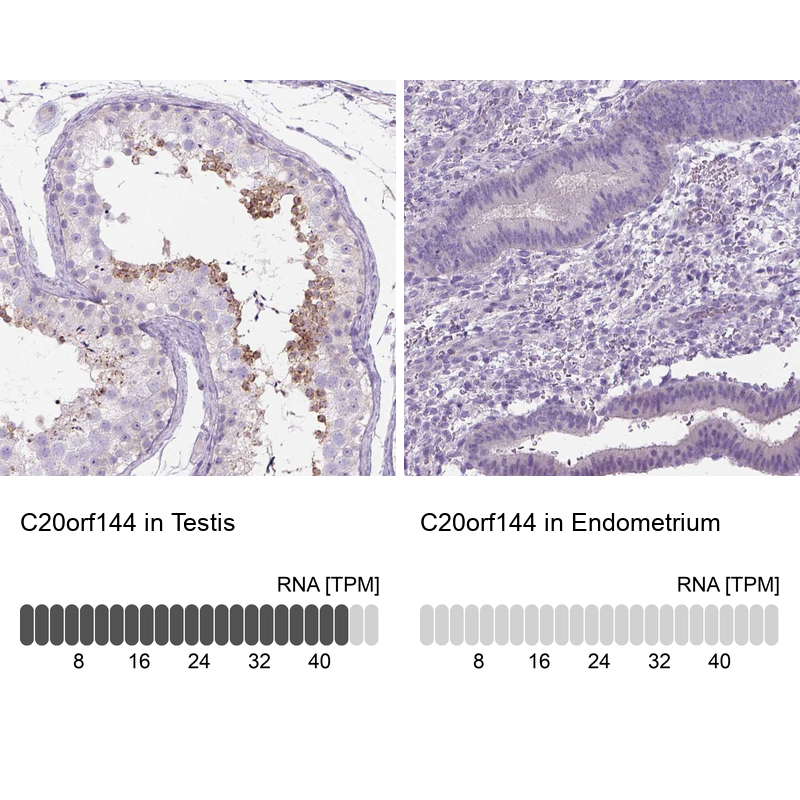 Anti-C20orf144 Antibody