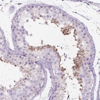 Immunohistochemical staining of human testis shows high expression.