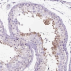 Immunohistochemical staining of human testis shows high expression.