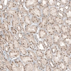 Immunohistochemical staining of human kidney shows moderate nuclear positivity in cells in tubules.