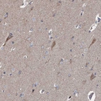 Immunohistochemical staining of human cerebral cortex shows strong cytoplasmic positivity in neurons.