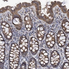 Immunohistochemical staining of human colon shows strong cytoplasmic positivity in glandular cells.