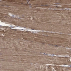 Immunohistochemical staining of human skeletal muscle shows strong cytoplasmic positivity in myocytes.