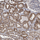 Immunohistochemical staining of human kidney shows strong cytoplasmic positivity in cells in tubules.