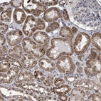 Immunohistochemical staining of human kidney shows strong cytoplasmic positivity in cells in tubules.