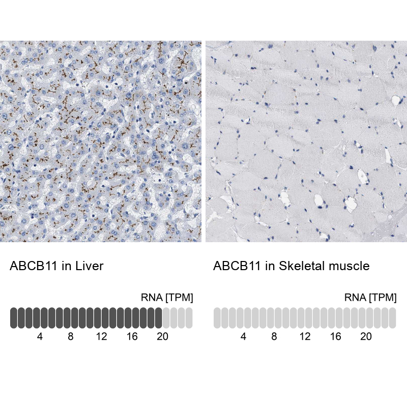 Anti-ABCB11 Antibody