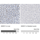 Anti-ABCB11 Antibody