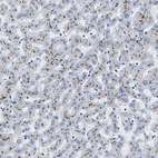 Immunohistochemical staining of human liver shows moderate to strong membranous positivity in bile canaliculi.