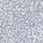 Immunohistochemical staining of human liver shows moderate to strong membranous positivity in bile canaliculi.