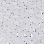 Immunohistochemical staining of human skeletal muscle shows no positivity in myocytes as expected.