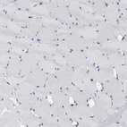 Anti-ABCB11 Antibody