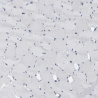 Immunohistochemical staining of human skeletal muscle shows no positivity in myocytes as expected.