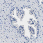 Immunohistochemical staining of human prostate shows no positivity in glandular cells as expected.