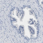 Immunohistochemical staining of human prostate shows no positivity in glandular cells as expected.