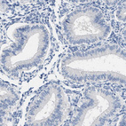 Anti-ABCB11 Antibody