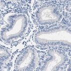Immunohistochemical staining of human endometrium shows no positivity in glandular cells as expected.