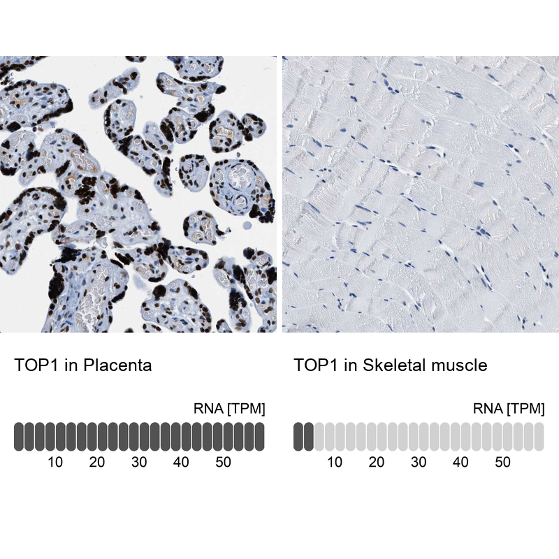 Anti-TOP1 Antibody