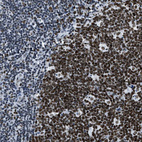 Immunohistochemical staining of human lymphoid tissues shows strong nuclear positivity in germinal center cells.