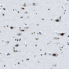 Immunohistochemical staining of human cerebral cortex shows strong nuclear positivity in neurons.